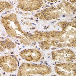 Anti-APC5 antibody used in IHC (Paraffin sections) (IHC-P). GTX33008