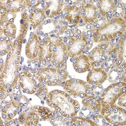 Anti-APC5 antibody used in IHC (Paraffin sections) (IHC-P). GTX33008