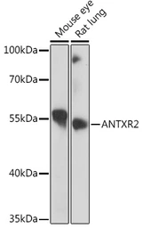 Anti-ANTXR2 antibody used in Western Blot (WB). GTX33011