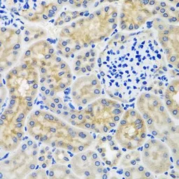Anti-ANTXR2 antibody used in IHC (Paraffin sections) (IHC-P). GTX33011