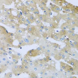 Anti-AP1M2 antibody used in IHC (Paraffin sections) (IHC-P). GTX33012