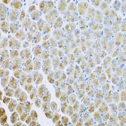 Anti-AP1M2 antibody used in IHC (Paraffin sections) (IHC-P). GTX33012