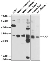 Anti-APIP antibody used in Western Blot (WB). GTX33013