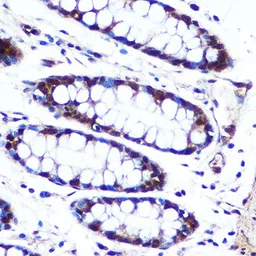 Anti-APIP antibody used in IHC (Paraffin sections) (IHC-P). GTX33013