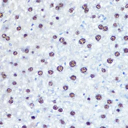 Anti-APIP antibody used in IHC (Paraffin sections) (IHC-P). GTX33013