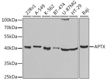 Anti-Aprataxin antibody used in Western Blot (WB). GTX33016
