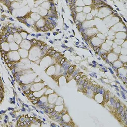 Anti-ARHGEF11 antibody used in IHC (Paraffin sections) (IHC-P). GTX33017
