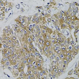 Anti-ARHGEF11 antibody used in IHC (Paraffin sections) (IHC-P). GTX33017