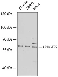 Anti-ARHGEF9 antibody used in Western Blot (WB). GTX33018