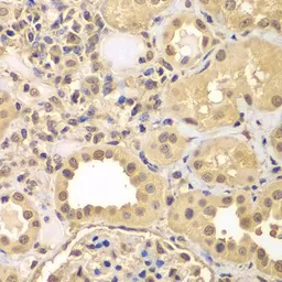 Anti-ARNT2 antibody used in IHC (Paraffin sections) (IHC-P). GTX33019