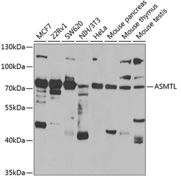 Anti-ASMTL antibody used in Western Blot (WB). GTX33021