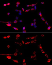 Anti-TUG antibody used in Immunocytochemistry/ Immunofluorescence (ICC/IF). GTX33023