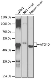 Anti-ATG4D antibody used in Western Blot (WB). GTX33025