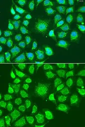 Anti-ATG4D antibody used in Immunocytochemistry/ Immunofluorescence (ICC/IF). GTX33025