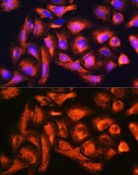 Anti-B9D1 antibody used in Immunocytochemistry/ Immunofluorescence (ICC/IF). GTX33030