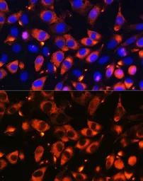 Anti-B9D1 antibody used in Immunocytochemistry/ Immunofluorescence (ICC/IF). GTX33030