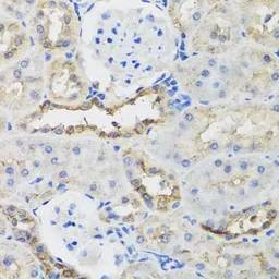 Anti-B9D1 antibody used in IHC (Paraffin sections) (IHC-P). GTX33030