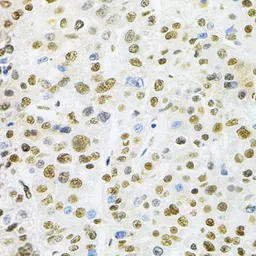Anti-BAF57 antibody used in IHC (Paraffin sections) (IHC-P). GTX33031