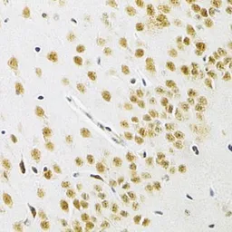 Anti-BAF57 antibody used in IHC (Paraffin sections) (IHC-P). GTX33031