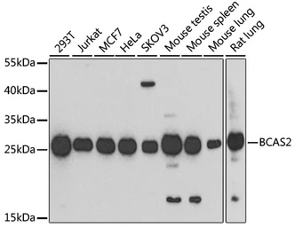 Anti-BCAS2 antibody used in Western Blot (WB). GTX33035
