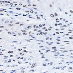 Anti-BCAS2 antibody used in IHC (Paraffin sections) (IHC-P). GTX33035