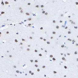Anti-BCAS2 antibody used in IHC (Paraffin sections) (IHC-P). GTX33035