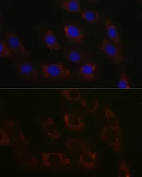 Anti-BCAT2 antibody used in Immunocytochemistry/ Immunofluorescence (ICC/IF). GTX33036