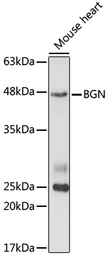 Anti-Biglycan antibody used in Western Blot (WB). GTX33038