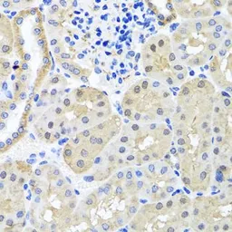 Anti-BSND antibody used in IHC (Paraffin sections) (IHC-P). GTX33045
