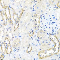 Anti-BSND antibody used in IHC (Paraffin sections) (IHC-P). GTX33045