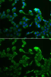 Anti-C1R antibody used in Immunocytochemistry/ Immunofluorescence (ICC/IF). GTX33049