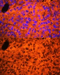 Anti-C3 / C3c antibody used in IHC (Paraffin sections) (IHC-P). GTX33050