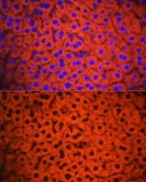 Anti-C3 / C3c antibody used in IHC (Paraffin sections) (IHC-P). GTX33050