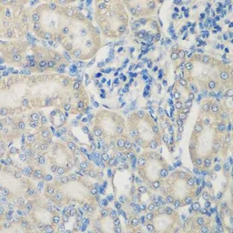 Anti-C3 / C3c antibody used in IHC (Paraffin sections) (IHC-P). GTX33050