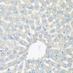 Anti-C3 / C3c antibody used in IHC (Paraffin sections) (IHC-P). GTX33050