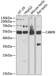 Anti-C4 binding protein B antibody used in Western Blot (WB). GTX33051