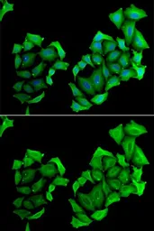 Anti-C4 binding protein B antibody used in Immunocytochemistry/ Immunofluorescence (ICC/IF). GTX33051