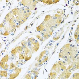 Anti-C4 binding protein B antibody used in IHC (Paraffin sections) (IHC-P). GTX33051