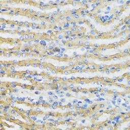Anti-C4 binding protein B antibody used in IHC (Paraffin sections) (IHC-P). GTX33051