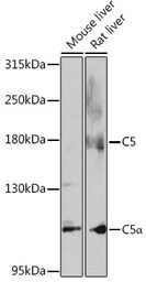 Anti-C5 / C5b antibody used in Western Blot (WB). GTX33052