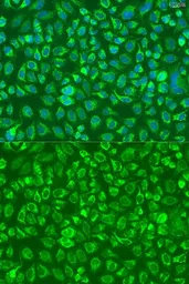 Anti-C5 / C5b antibody used in Immunocytochemistry/ Immunofluorescence (ICC/IF). GTX33052