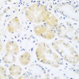 Anti-C5 / C5b antibody used in IHC (Paraffin sections) (IHC-P). GTX33052