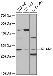 Anti-Calcipressin 1 antibody used in Western Blot (WB). GTX33055