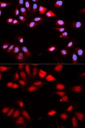 Anti-Calcipressin 1 antibody used in Immunocytochemistry/ Immunofluorescence (ICC/IF). GTX33055