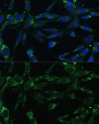 Anti-Calpain 5 antibody used in Immunocytochemistry/ Immunofluorescence (ICC/IF). GTX33057