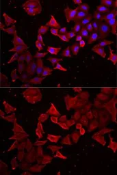 Anti-Caspase 14 antibody used in Immunocytochemistry/ Immunofluorescence (ICC/IF). GTX33063