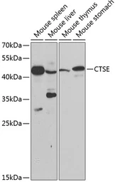 Anti-Cathepsin E antibody used in Western Blot (WB). GTX33064
