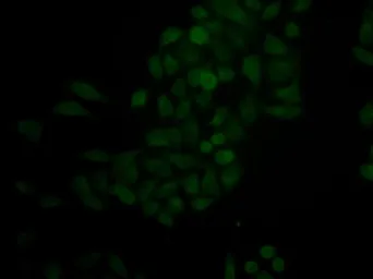Anti-Cathepsin E antibody used in Immunocytochemistry/ Immunofluorescence (ICC/IF). GTX33064
