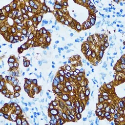 Anti-Cathepsin E antibody used in IHC (Paraffin sections) (IHC-P). GTX33064