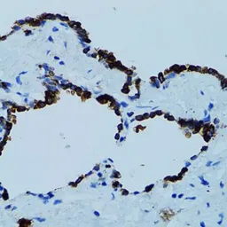 Anti-Cathepsin E antibody used in IHC (Paraffin sections) (IHC-P). GTX33064